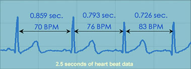 Heartbeat data
